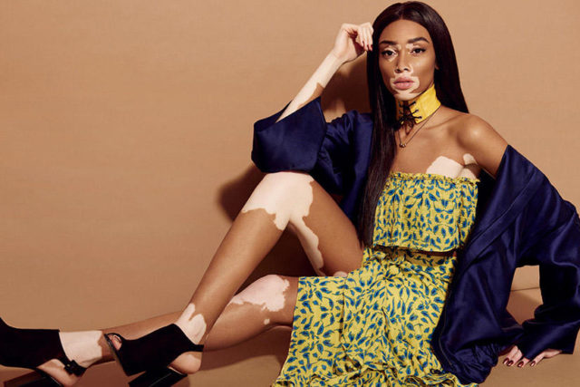 Winnie Harlow X ELLE Canada